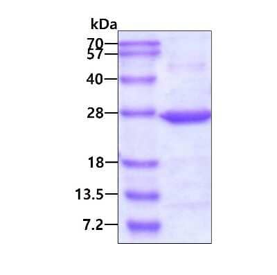 SDS-Page: Recombinant Human SAR1 His Protein [NBP1-30177] - 3ug by SDS-PAGE under reducing condition and visualized by coomassie blue stain.